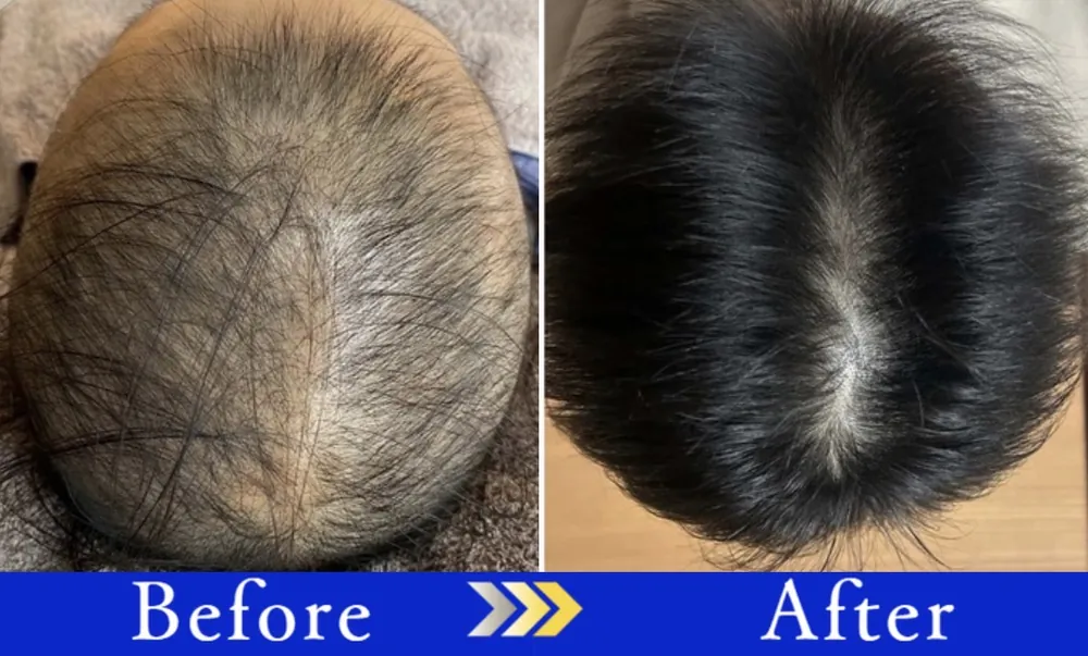 Before After はなおさん