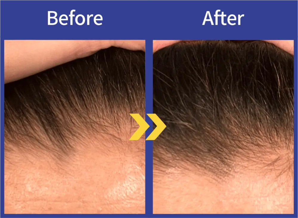 Before After
