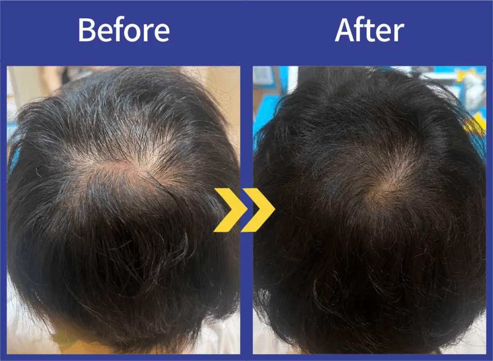 Before After