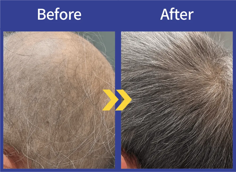 Before After