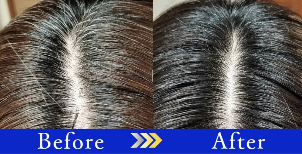 Before After りかさん