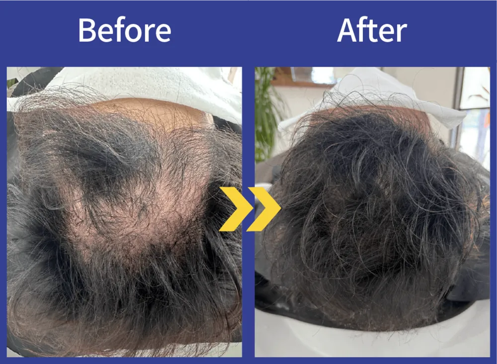 Before After