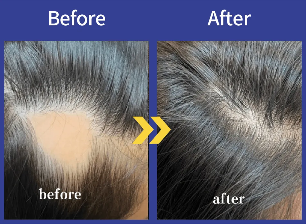 Before After