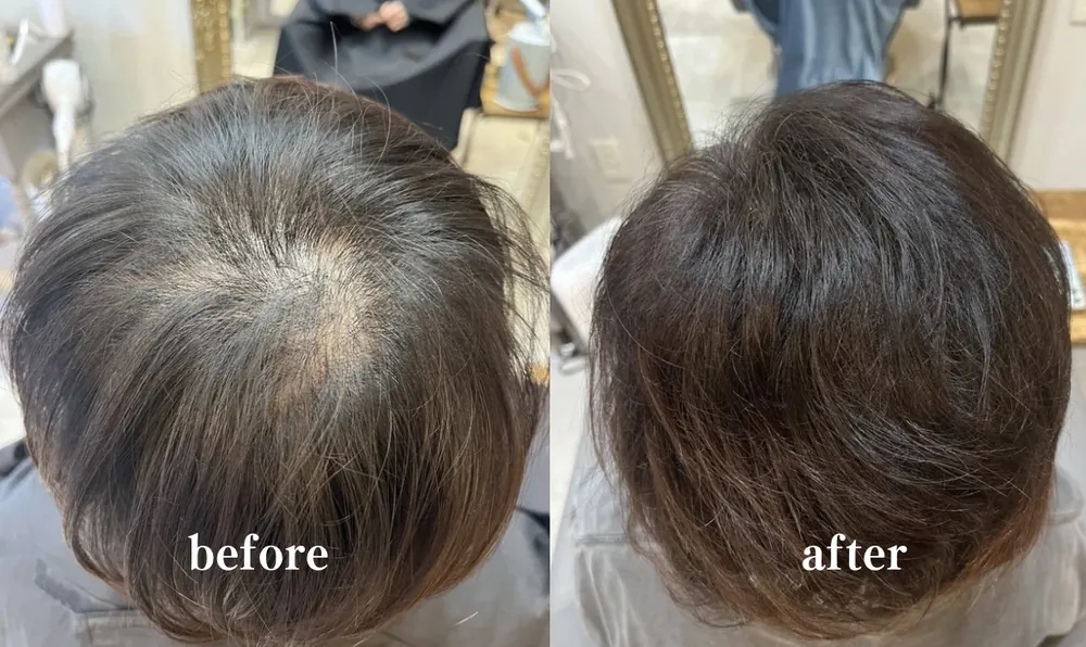 Before After