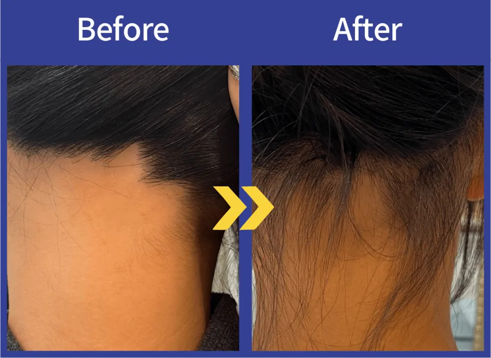 Before After