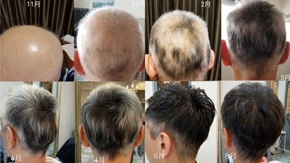 11月〜8月 劇的変化Before After