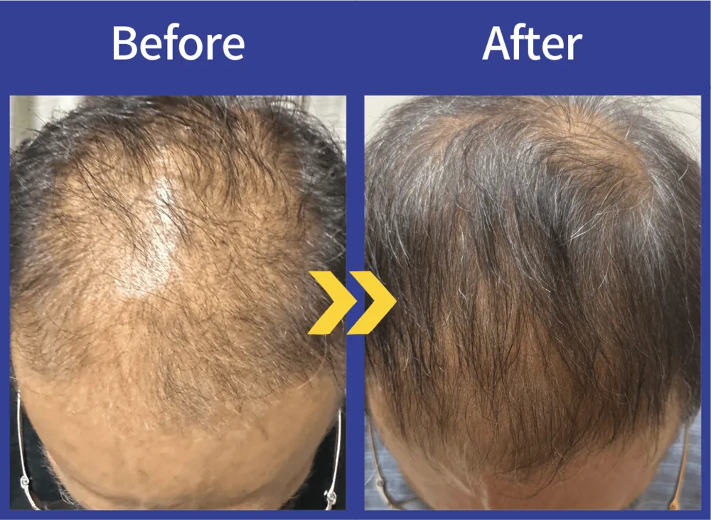 Before After
